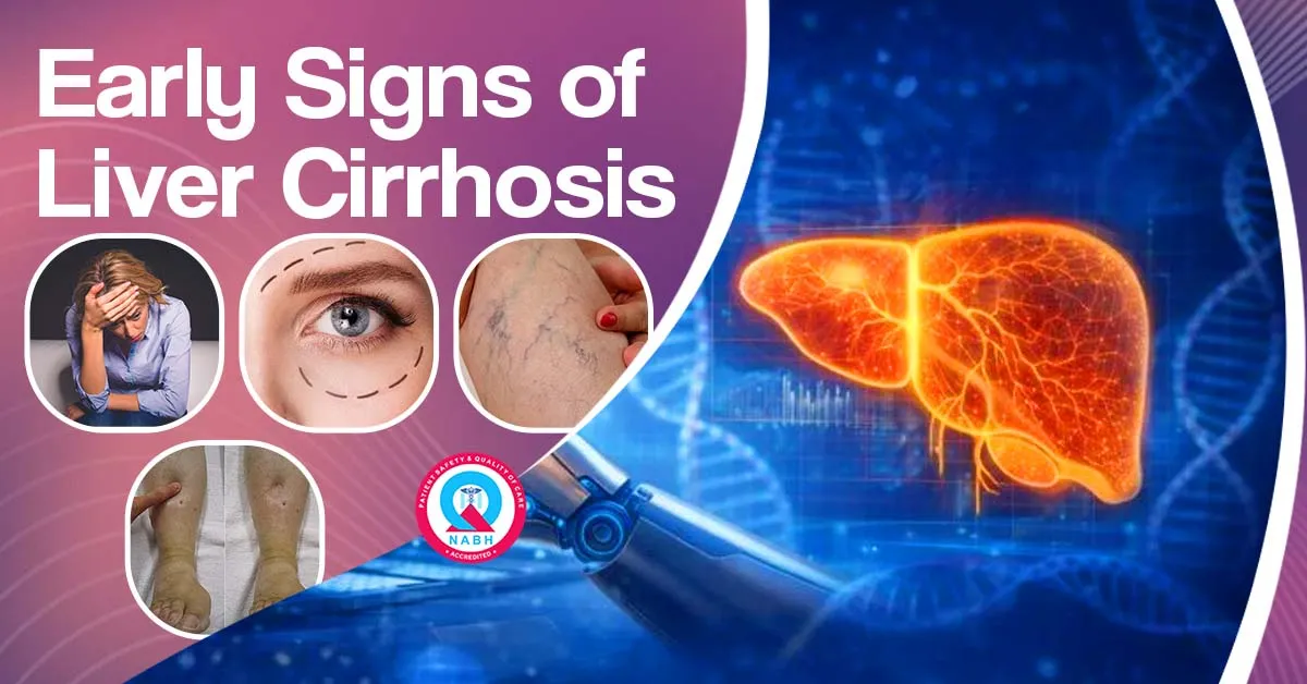 early-signs-of-liver-cirrhosis